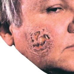 Morris Costumes Newest Products Pus Prosthetic